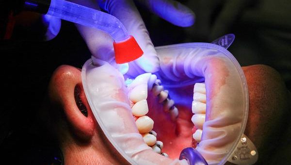 Najczęściej polecany dentysta przez pacjentów